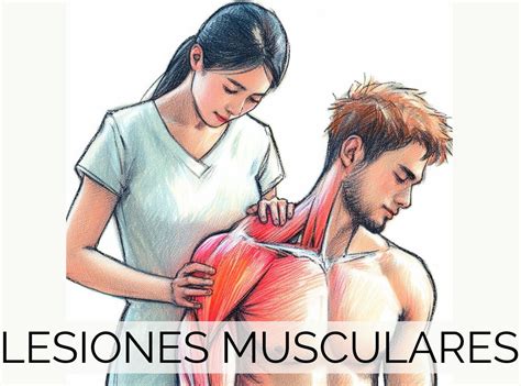 Infografía del método PRICE para lesiones musculares