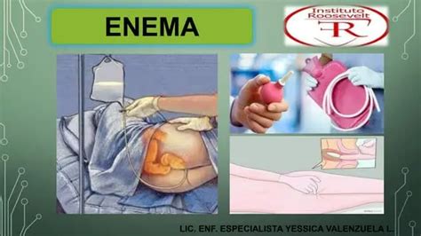 Diagrama mostrando la inserción correcta de un enema