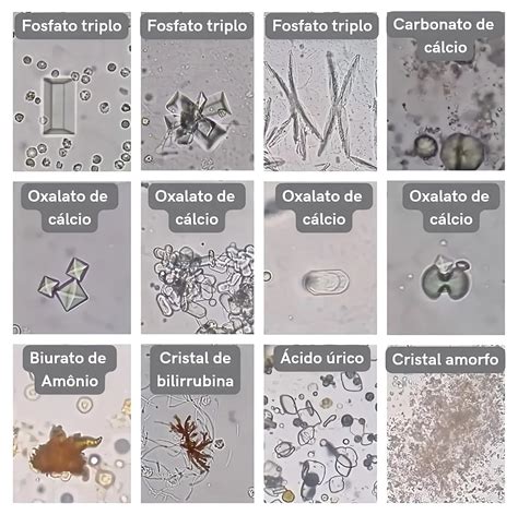 Cristales de carbonato de sodio o representación de su estructura química
