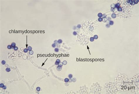 Micrografía de Candida albicans mostrando pseudohifas y blastosporas