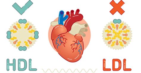 Infografía: Beneficios para la salud de la margarina vegetal (colesterol LDL, HDL, grasas trans)