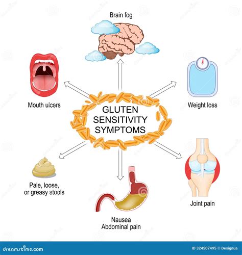 infografía comparativa de enfermedad celíaca, sensibilidad al gluten y alergia al trigo