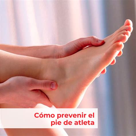 Foto de una persona aplicando crema antimicótica en el pie de atleta, mostrando la forma correcta de extender el producto
