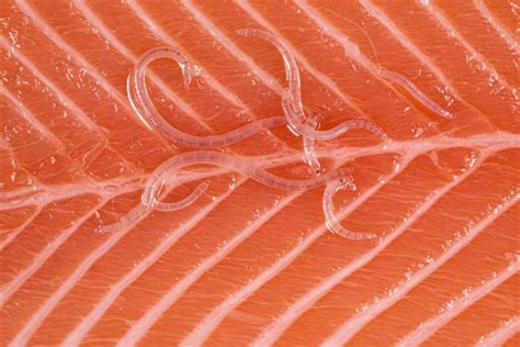 Foto microscópica de larvas de anisakis