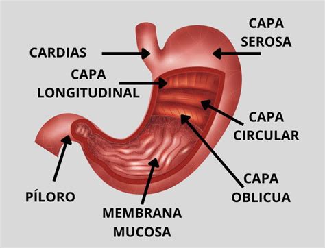 Esquema de las partes del estómago y la mucosa gástrica inflamada