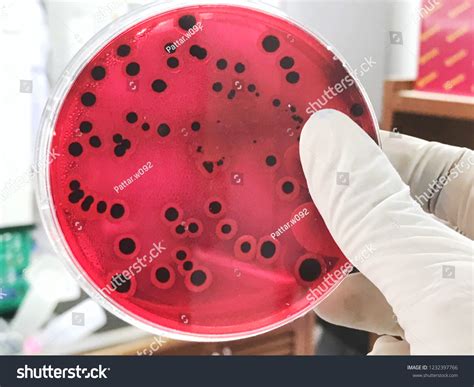 placa de agar con colonias de Salmonella, mostrando el centro negro característico