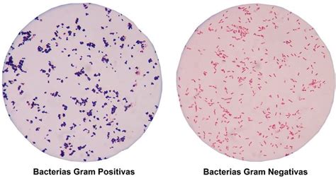 microscopio con tinción Gram de bacterias y placas de agar con colonias