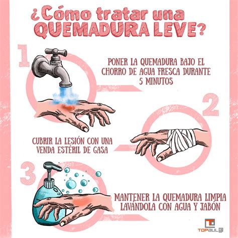 Primeros auxilios para quemaduras de aceite