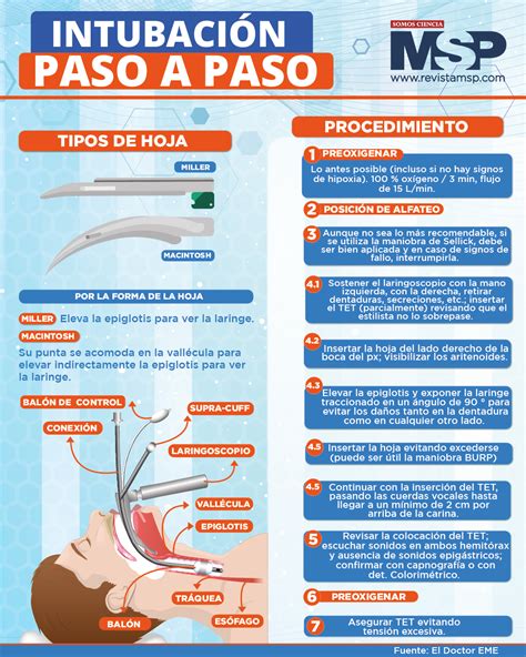 Diagrama mostrando la posición correcta de la cabeza del neonato para la intubación