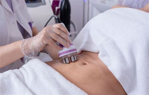 representación gráfica de un tratamiento de radiofrecuencia para celulitis