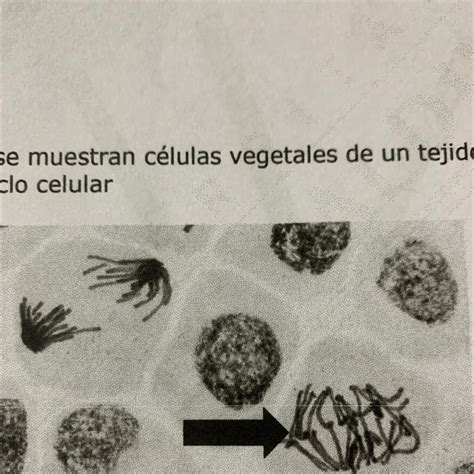 Microfotografía de células de Xantomonas campestris.