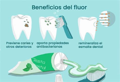 Infografía explicando el efecto del fluoruro en la salud dental infantil