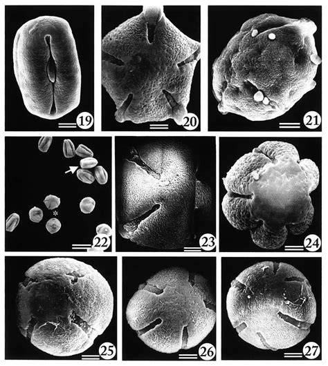 Microscopía de granos de polen de maíz sobre sedas