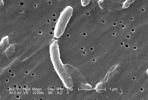 Micrografía electrónica de Vibrio parahaemolyticus.