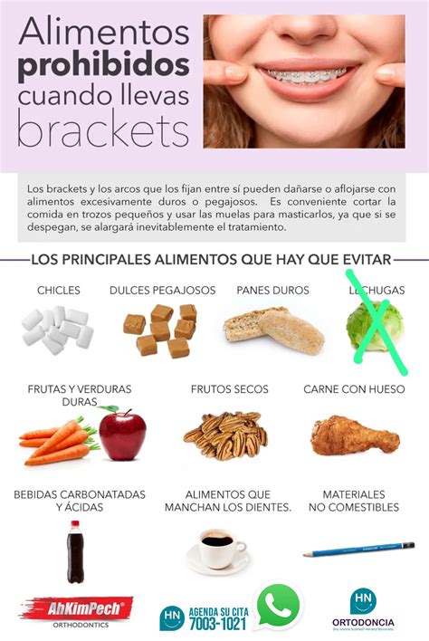 Gráfico de alimentos a evitar cuando se llevan brackets