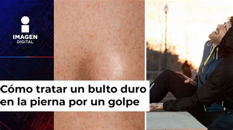 Ilustración de una persona palpando un bulto en la pierna