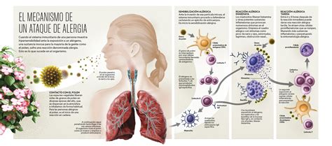 infografía sobre respuesta alérgica en el cuerpo