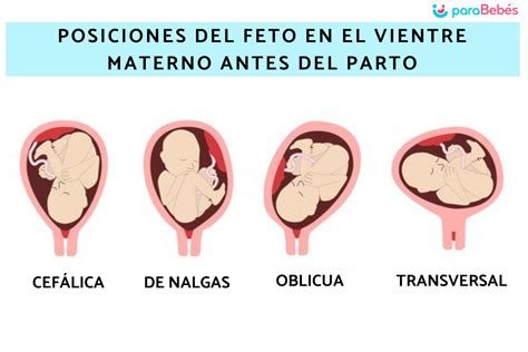 diagrama de las diferentes posiciones fetales (cefálica, podálica, transversal)