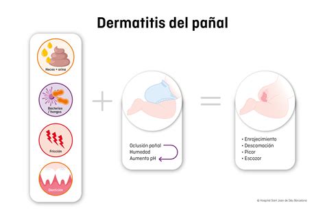 Diagrama ilustrando las causas comunes de la dermatitis del pañal: irritación por humedad, proliferación de hongos y bacterias en ambientes cálidos, y reacciones alérgicas a productos.