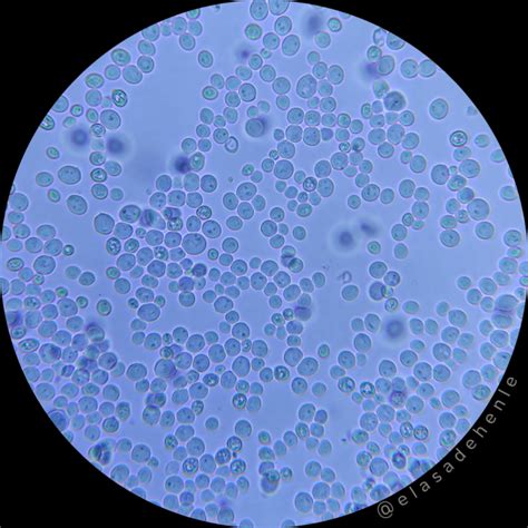 Foto de levaduras bajo el microscopio (aumento 40x)