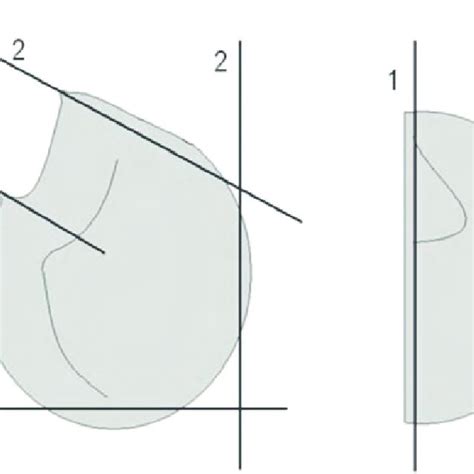 Esquema de los cortes realizados en la masa para diferentes facturas