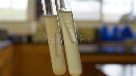 Fotografía de laboratorio comparando tubos positivos y negativos en caldo con campana de Durham.