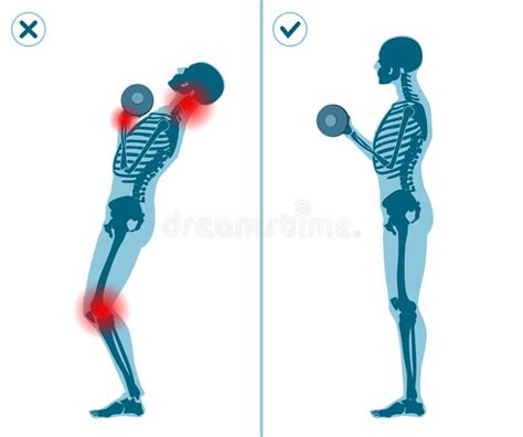 Infografía comparativa: técnica correcta vs. errores comunes (como el exceso de arco lumbar).