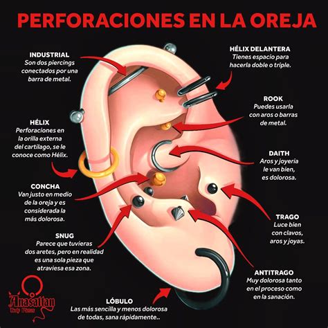 Esquema de un piercing en la oreja mostrando la acumulación de células muertas, sebo y bacterias alrededor del túnel de perforación