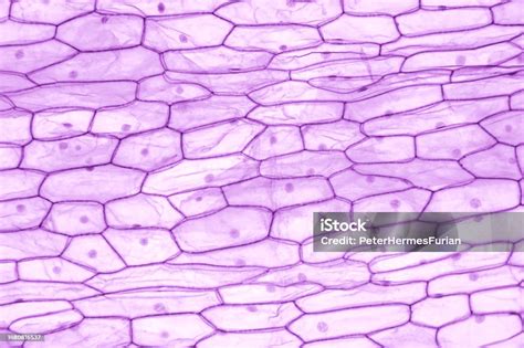 Micrografía de células de epidermis de cebolla mostrando su forma y núcleo
