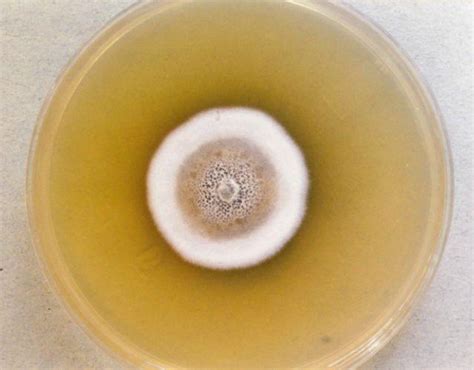 Colonia de Uncinocarpus reesii creciendo en agar papa dextrosa