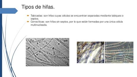 Micrografía óptica: comparación de hifas tabicadas y células en gemación
