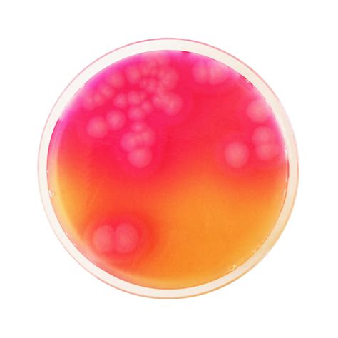 Ilustración de colonias de Bacillus cereus con halo de precipitación en agar MYP.