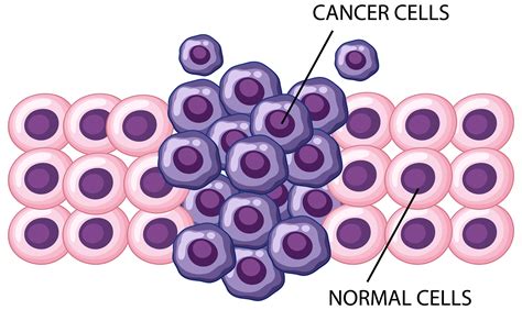 Representación gráfica de células cancerosas de mama multiplicándose.