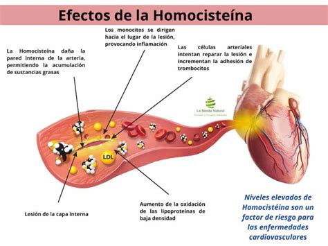 Infografía sobre la relación entre homocisteína, folato y enfermedad cardiovascular