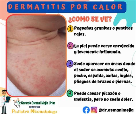 comparación de sarpullido por calor y dermatitis de contacto