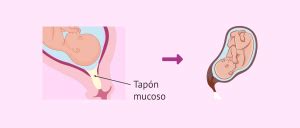 Diagrama del cuello uterino y la formación del tapón mucoso durante el embarazo