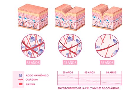 Infografía: cómo el consumo de lácteos afecta las hormonas y la piel
