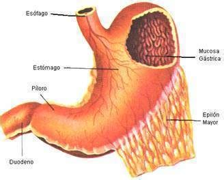 Esquema de las partes del estómago mostrando la inflamación de la mucosa gástrica