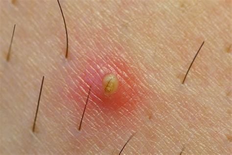 Foto de un dermatólogo examinando la piel con vellos encarnados