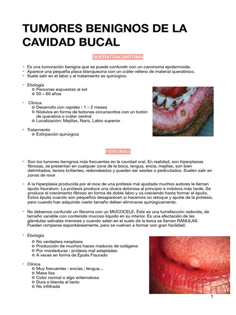 Tabla comparativa de bultos benignos y malignos en la cavidad oral