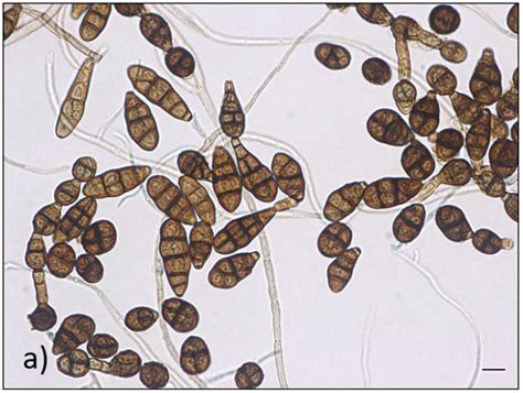 Micrografía de esporas del hongo Alternaria