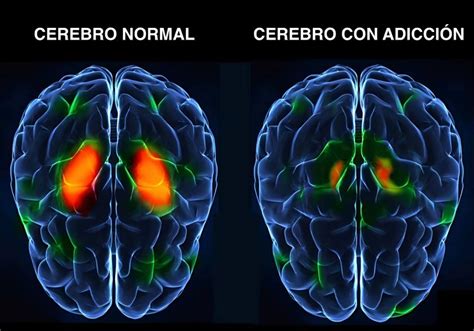 Ilustración del cerebro mostrando áreas de placer y adicción