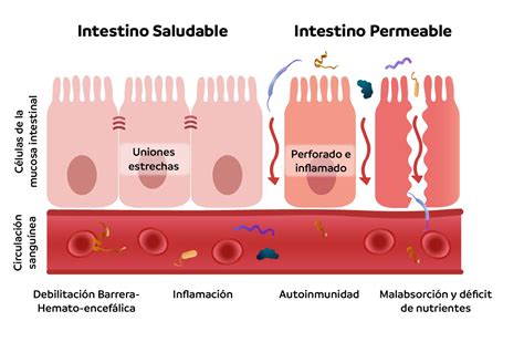 esquema: Intestino sano vs. intestino con permeabilidad intestinal