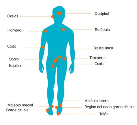 Esquema de las áreas del cuerpo que pueden ser afectadas por la candidiasis