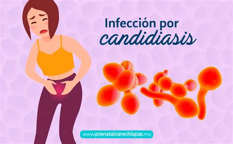 Foto de una erupción de pañal causada por Candida