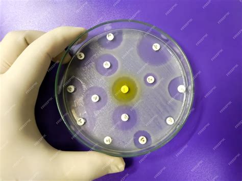 Placa de cultivo con discos de antibióticos para pruebas de sensibilidad.