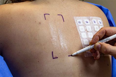 Persona realizando una prueba de parche de un producto en su antebrazo
