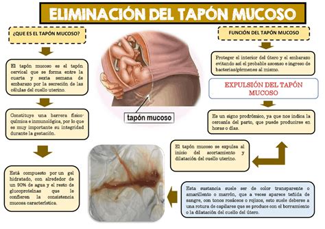 Ilustración esquemática del tapón mucoso y la bolsa amniótica.
