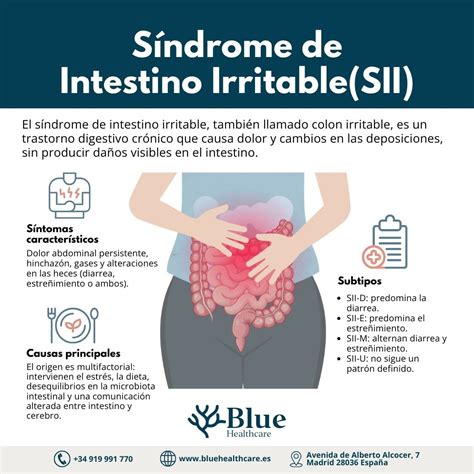 Esquema de los síntomas comunes del colon irritable como hinchazón, dolor abdominal y alteraciones en el tránsito intestinal