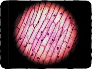 Microfotografía de células de epidermis de cebolla a 10x con tinción